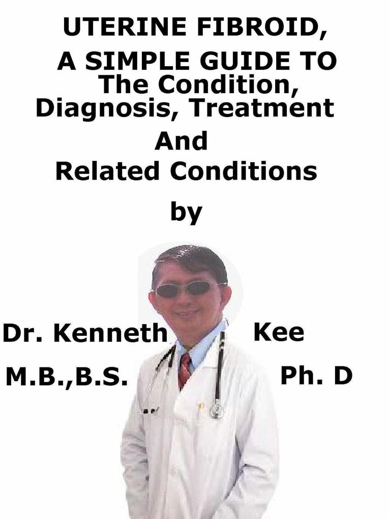 Uterine Fibroid A Simple Guide To The Condition Diagnosis Treatment And Related Conditions