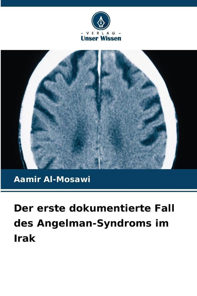 Der erste dokumentierte Fall des Angelman-Syndroms im Irak