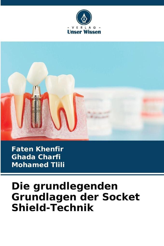 Die grundlegenden Grundlagen der Socket Shield-Technik