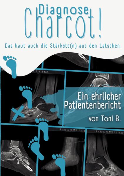 Diagnose Charcot!