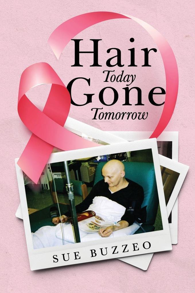 Hair Today Gone Tomorrow
