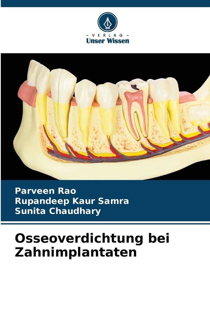 Osseoverdichtung bei Zahnimplantaten