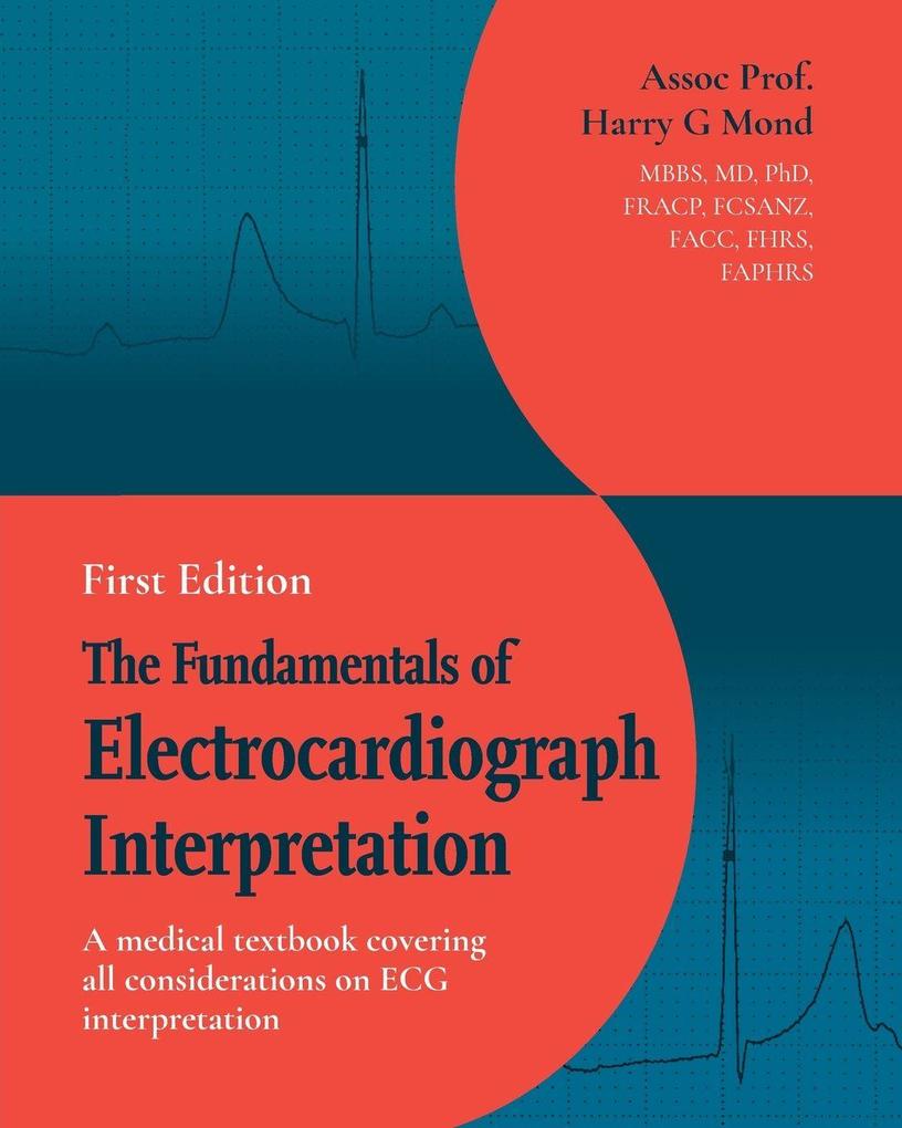 The Fundamentals of Electrocardiograph Interpretation