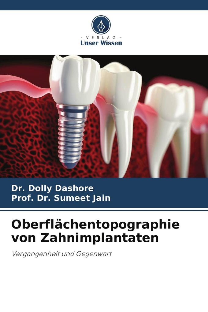 Oberflächentopographie von Zahnimplantaten