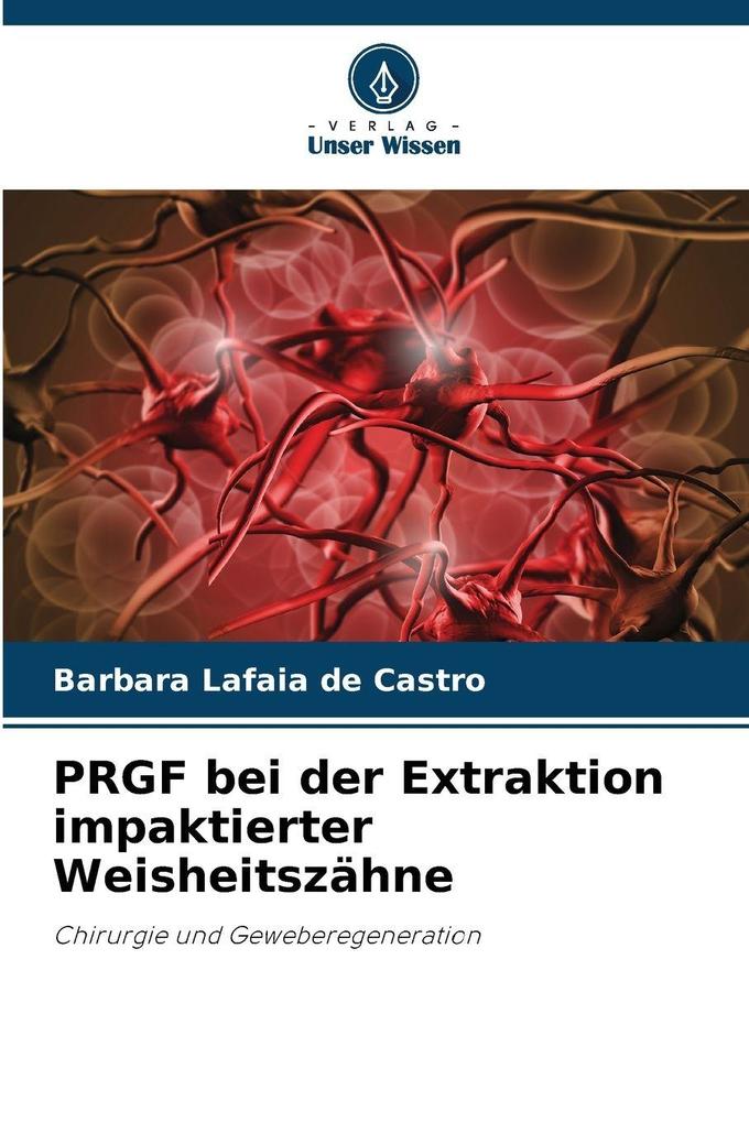PRGF bei der Extraktion impaktierter Weisheitszähne