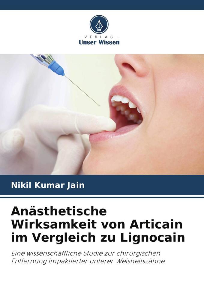 Anästhetische Wirksamkeit von Articain im Vergleich zu Lignocain