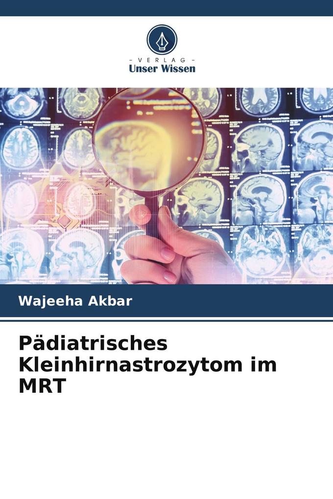 Pädiatrisches Kleinhirnastrozytom im MRT