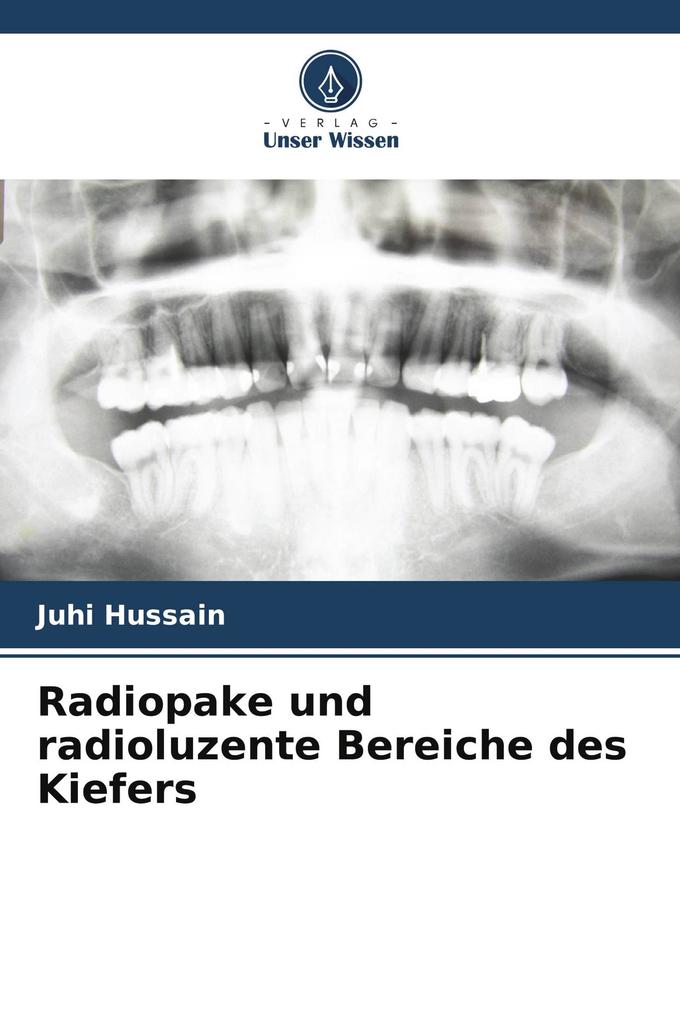 Radiopake und radioluzente Bereiche des Kiefers