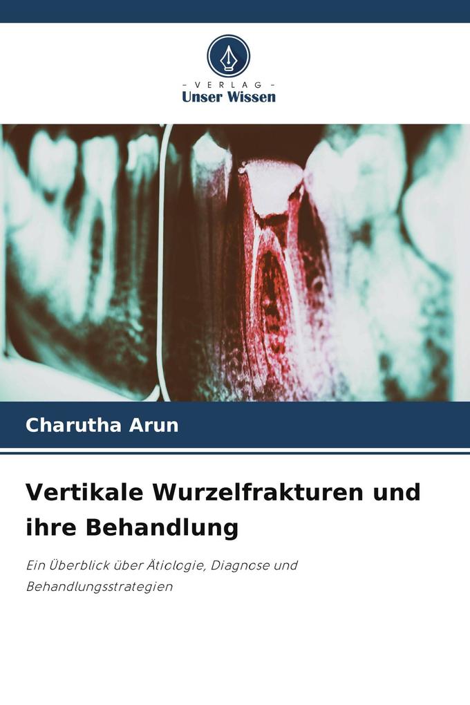 Vertikale Wurzelfrakturen und ihre Behandlung