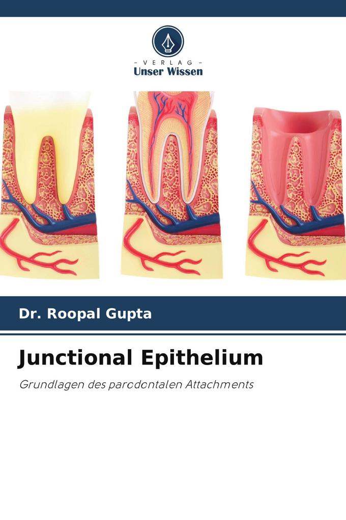 Junctional Epithelium