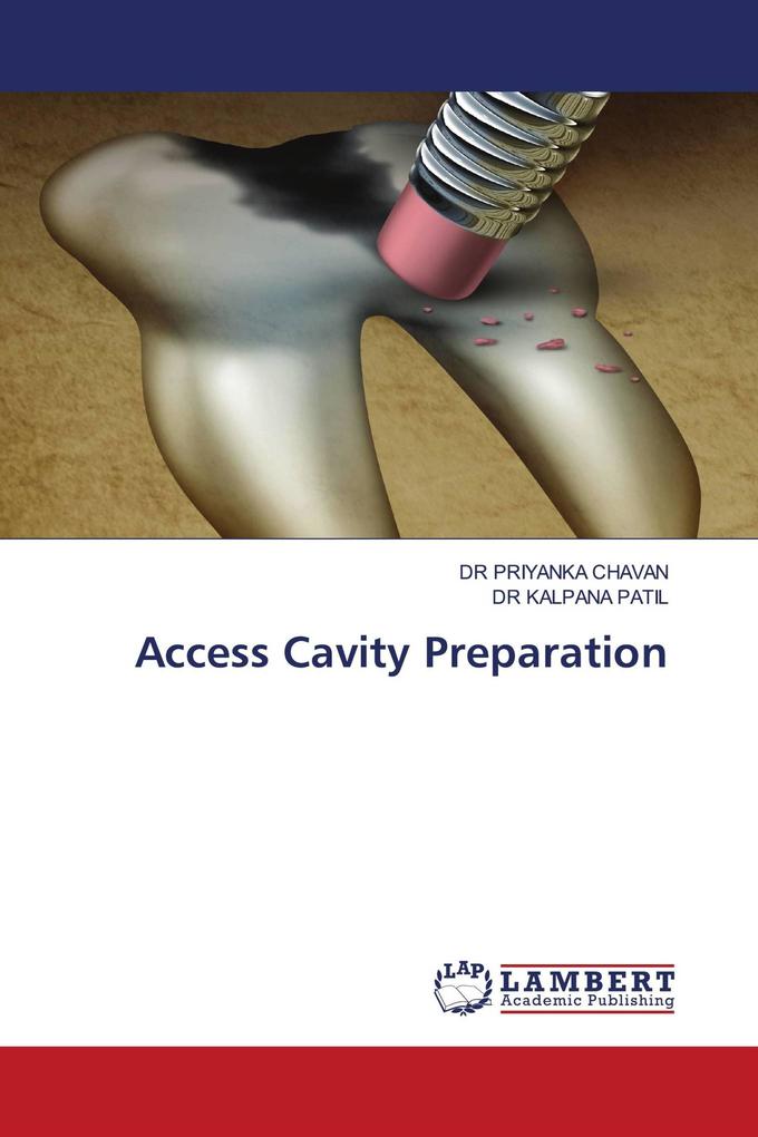 Access Cavity Preparation