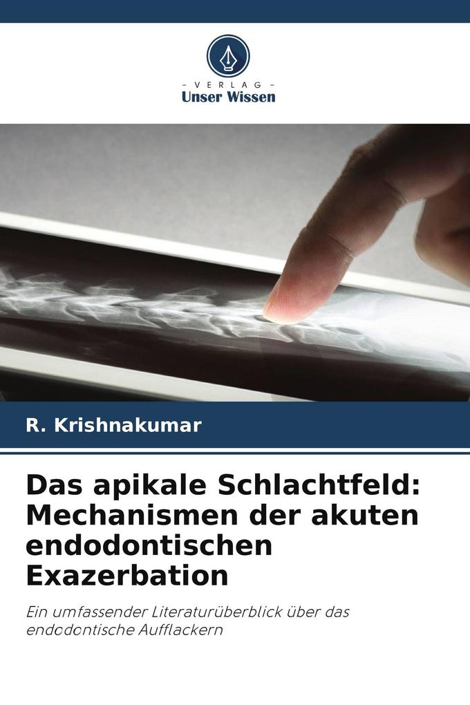 Das apikale Schlachtfeld: Mechanismen der akuten endodontischen Exazerbation