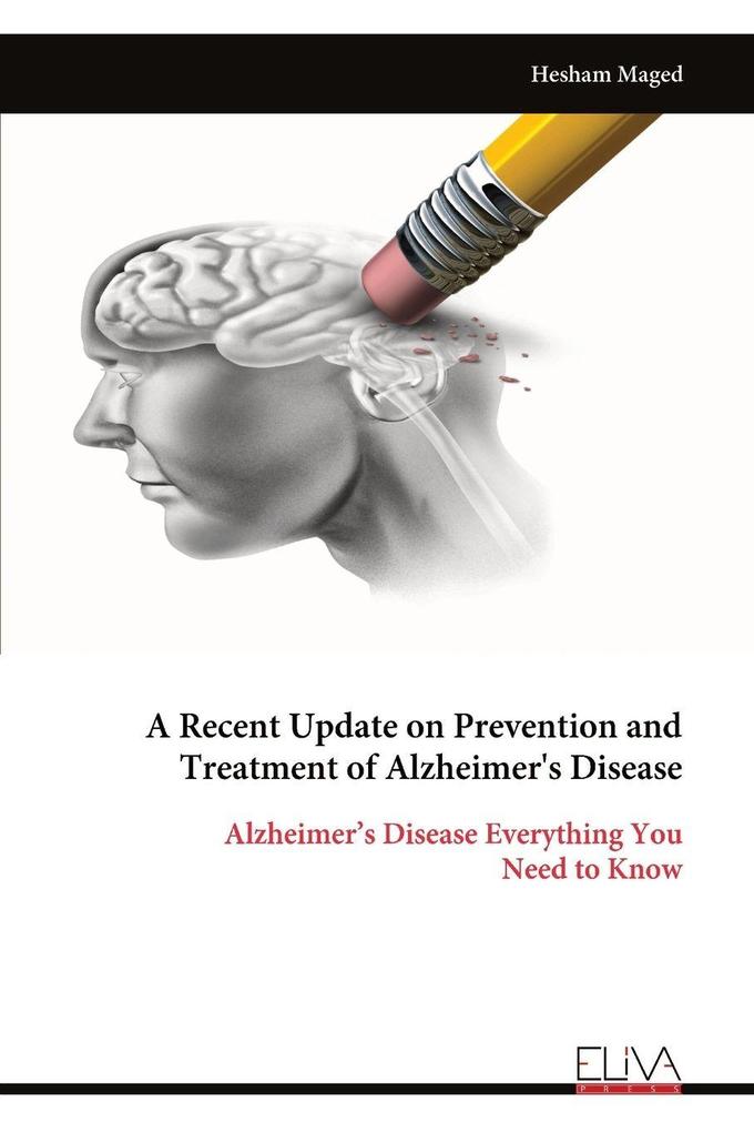 A Recent Update on Prevention and Treatment of Alzheimer's Disease