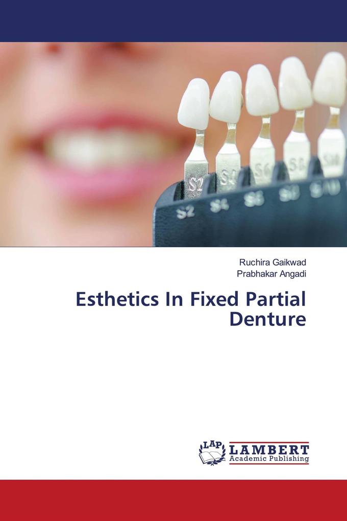 Esthetics In Fixed Partial Denture
