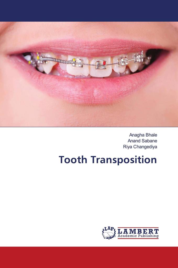 Tooth Transposition