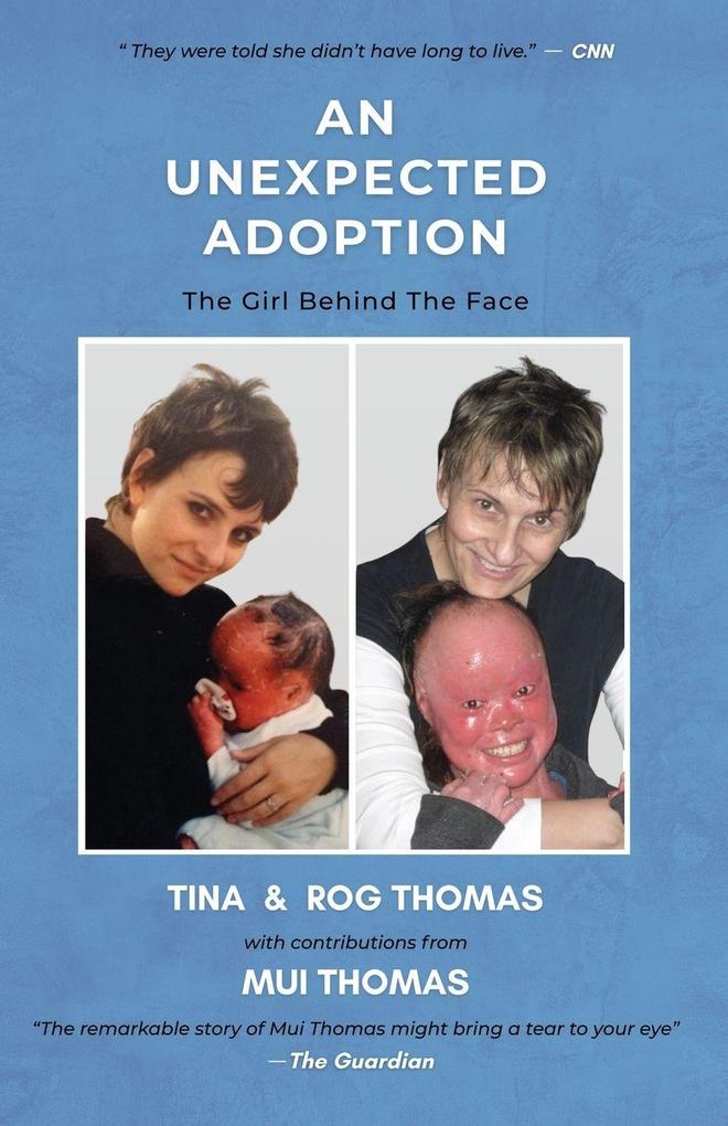 An Unexpected Adoption