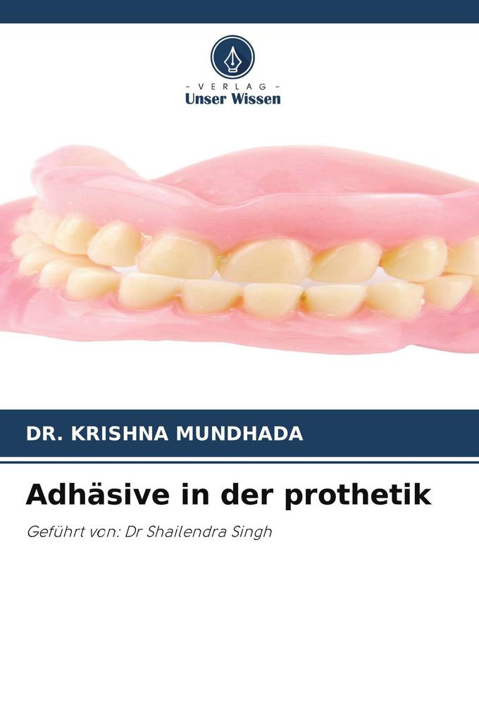 Adhäsive in der prothetik