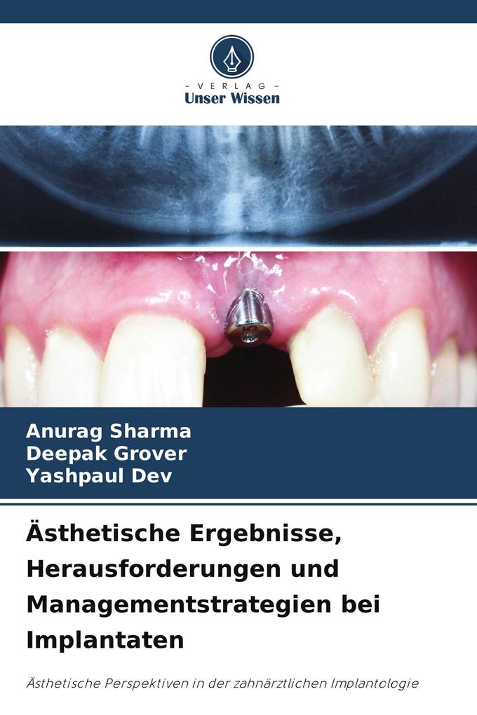 Ästhetische Ergebnisse Herausforderungen und Managementstrategien bei Implantaten