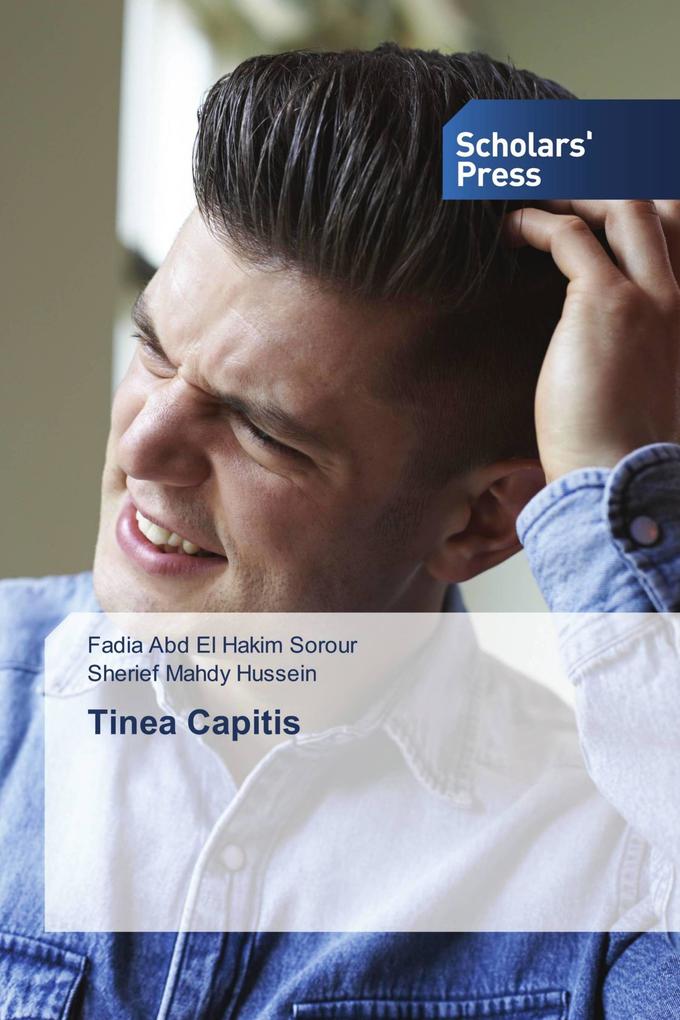 Tinea Capitis