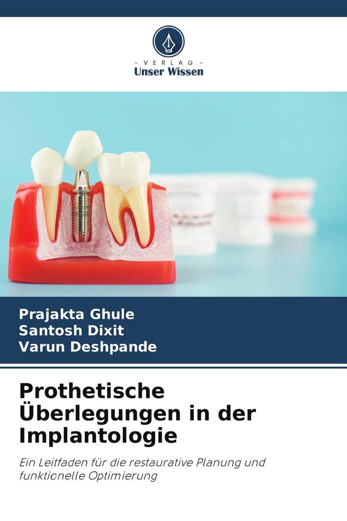 Prothetische Überlegungen in der Implantologie