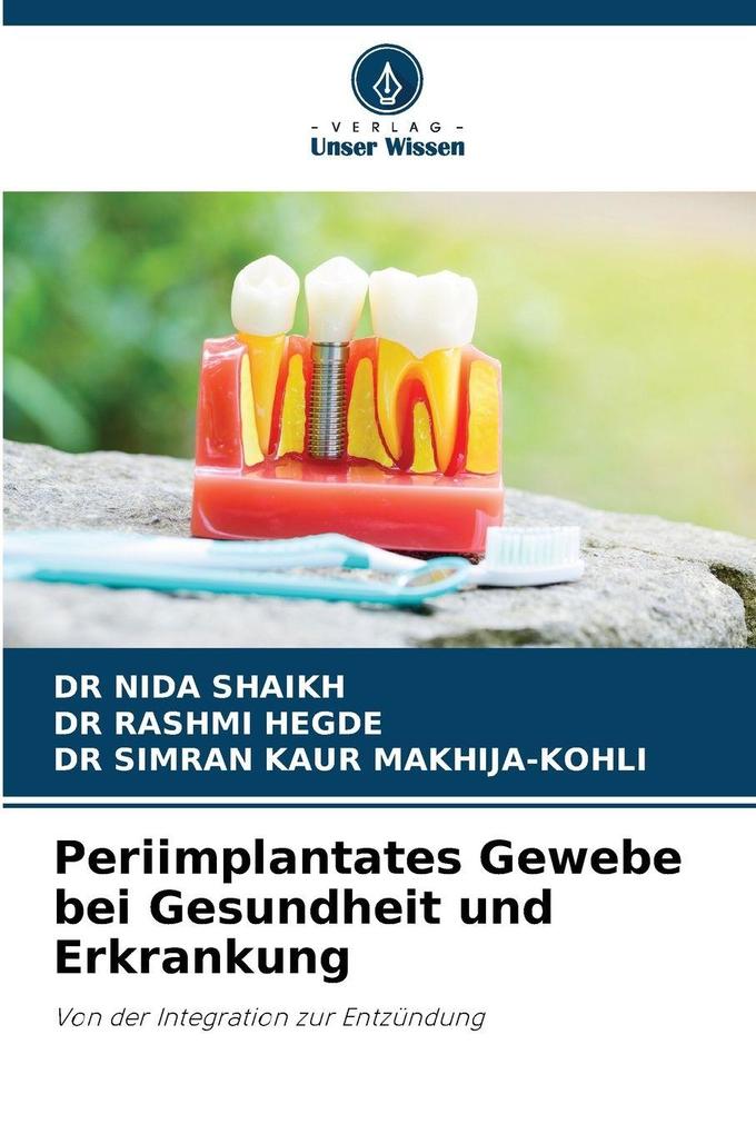 Periimplantates Gewebe bei Gesundheit und Erkrankung