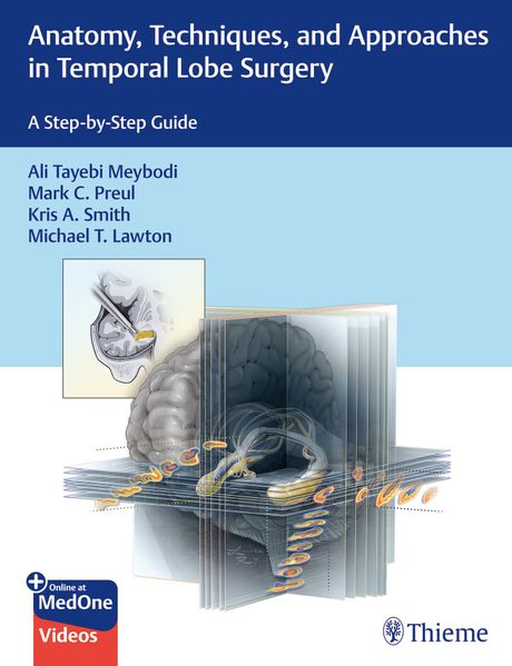 Anatomy Techniques and Approaches in Temporal Lobe Surgery