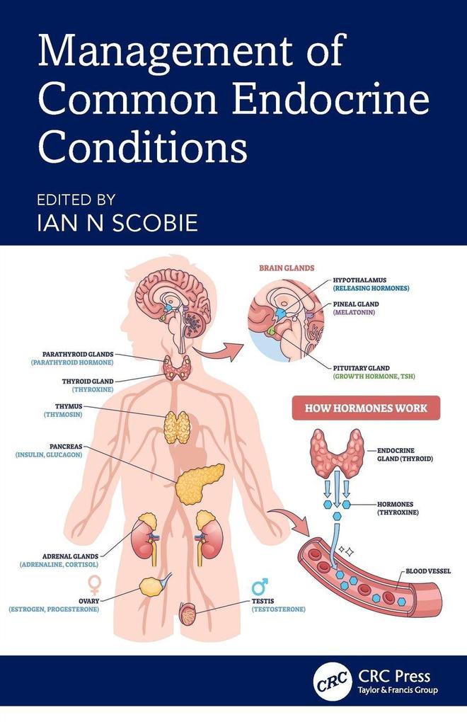 Management of Common Endocrine Conditions