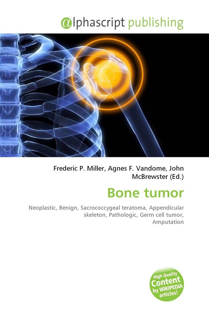 Bone tumor