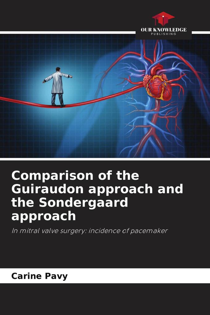 Comparison of the Guiraudon approach and the Sondergaard approach