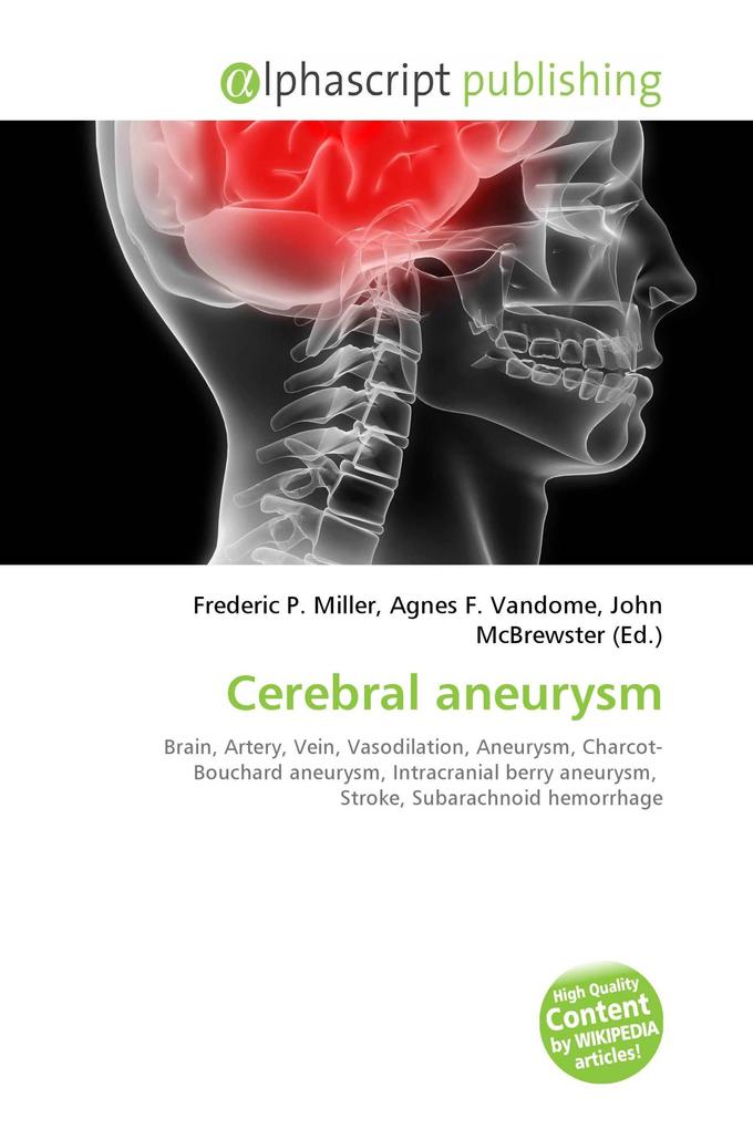 Cerebral aneurysm