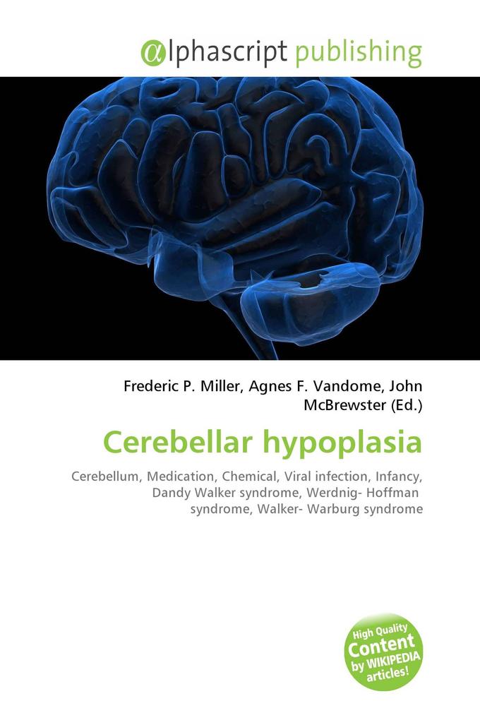 Cerebellar hypoplasia
