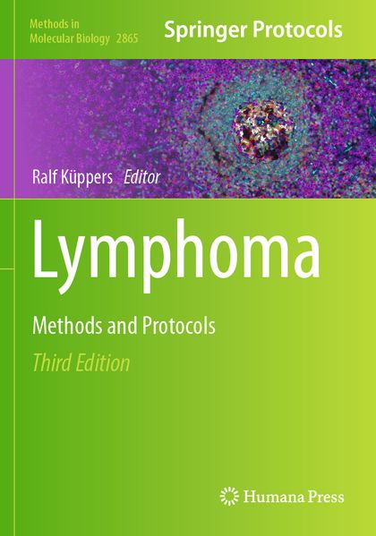 Lymphoma