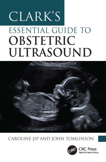 Clark's Essential Guide to Obstetric Ultrasound