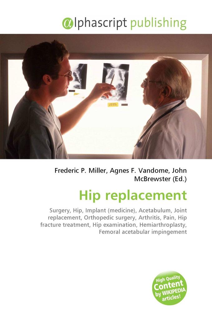 Hip replacement