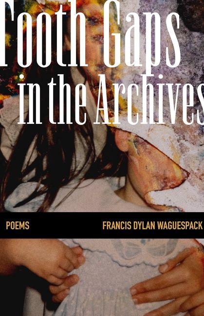 Tooth Gaps in the Archives