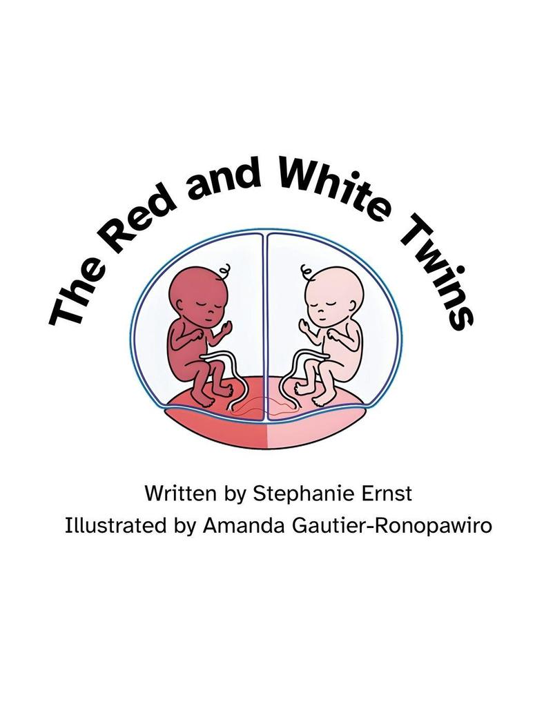 The Red and White Twins