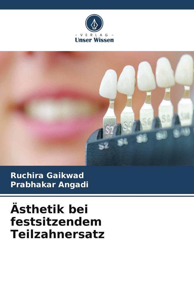 Ästhetik bei festsitzendem Teilzahnersatz