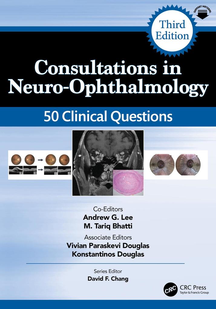 Consultations in Neuro-Ophthalmology