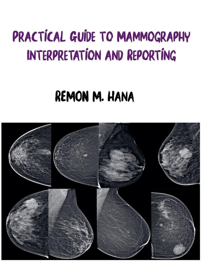 Practical Guide to Mammography Interpretation and Reporting