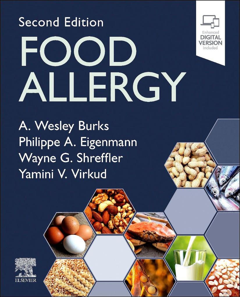 Food Allergy