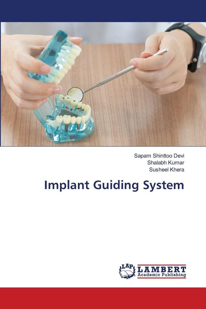 Implant Guiding System