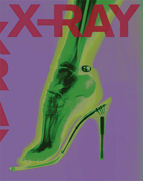X-RAY