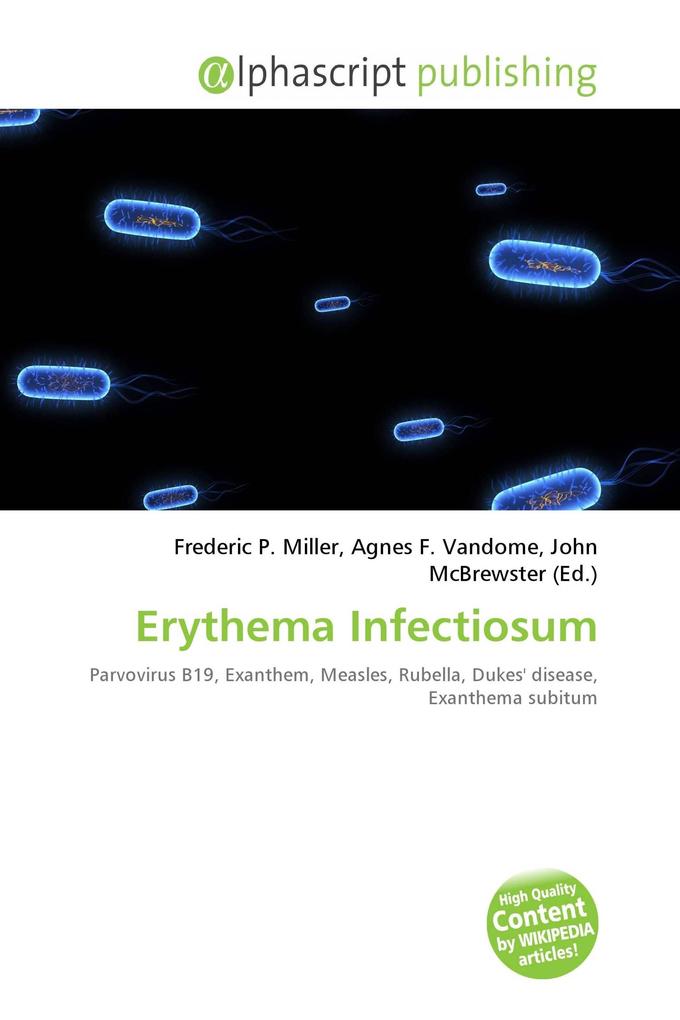 Erythema Infectiosum