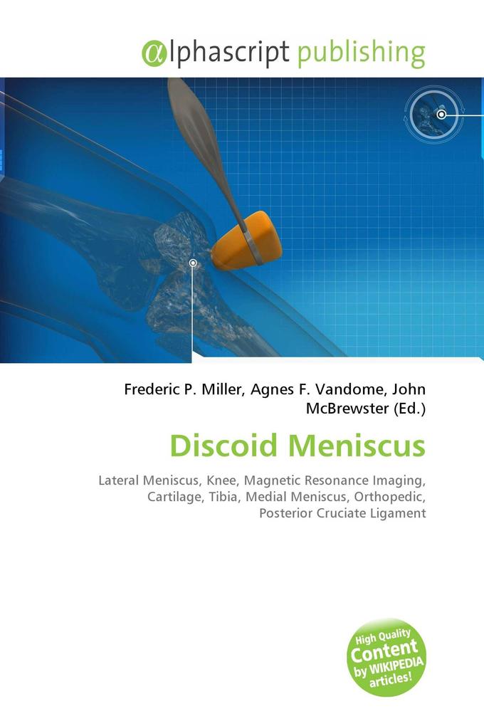 Discoid Meniscus