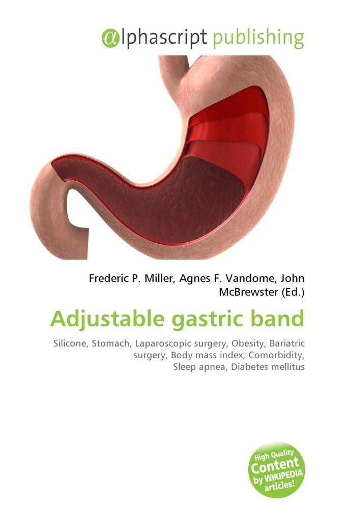 Adjustable gastric band