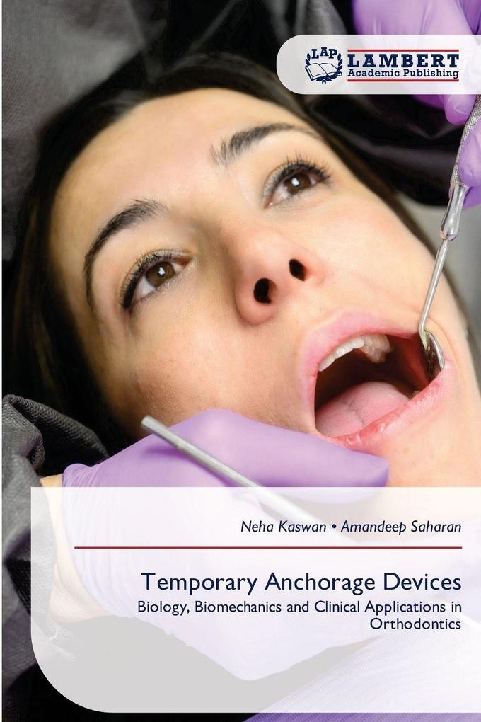 Temporary Anchorage Devices