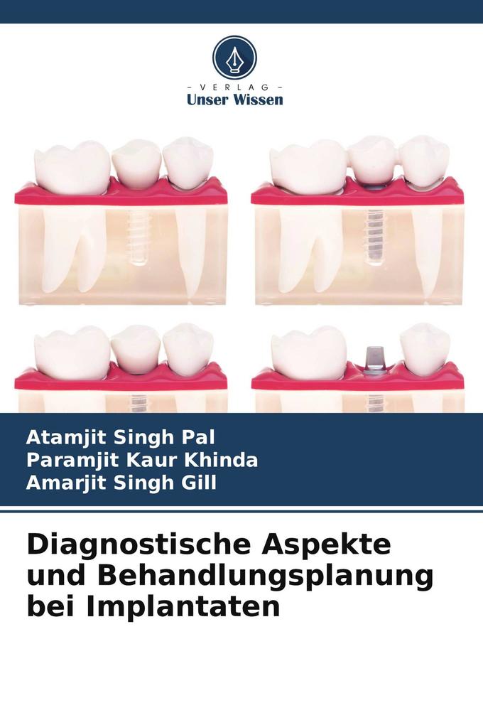 Diagnostische Aspekte und Behandlungsplanung bei Implantaten