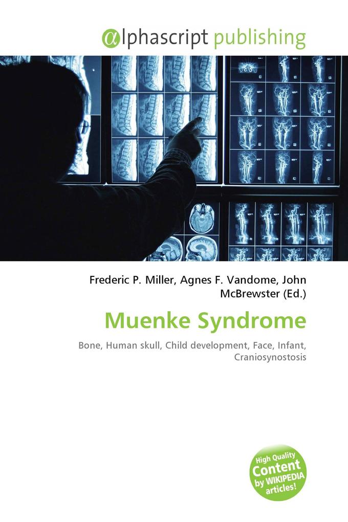 Muenke Syndrome
