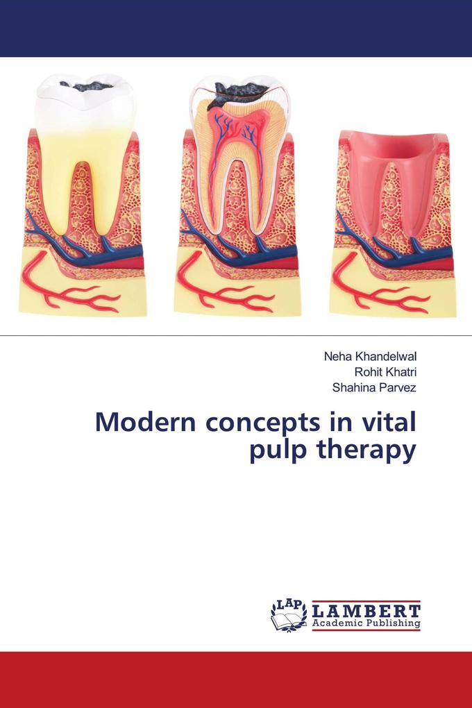 Modern concepts in vital pulp therapy