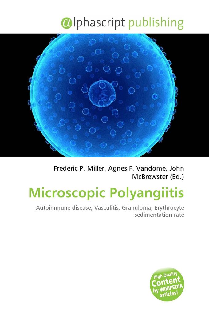 Microscopic Polyangiitis
